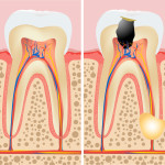 Tooth