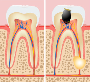 Tooth