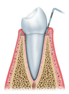 DENTE E GENGIVA SANI